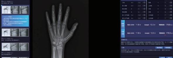 国家三类医疗认证！安智康生物儿童骨龄AI软件，精准赋能医疗机构合规高效诊疗