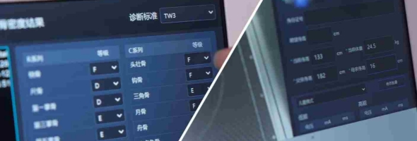 儿童骨龄评估不准、报告繁琐？安智龄智能AI骨龄仪以科技赋能儿童成长